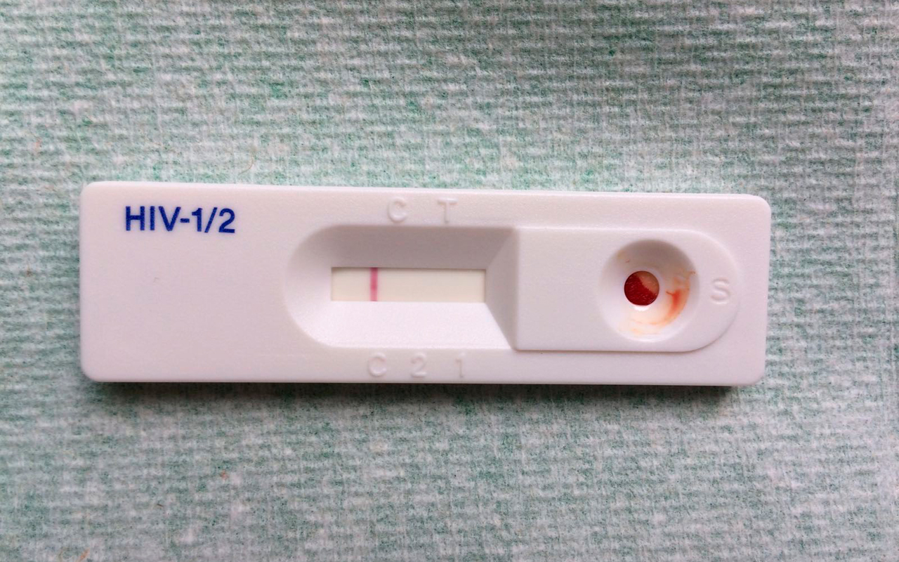 HIVinDV Types Of HIV Test